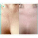 Biosmile Dekolte Kırışıklıklarını Önleyici Visco Yastık Standart Ebatlarda Pudra Renkli Orta Sertlik