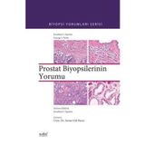 Biyopsilerin Yorumu Prostat - Nobel Tıp Kitabevleri