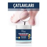 BLUE Skin Care Ayak, Topuk, Çatlak, Mantar, Koku, Ve Diyabetik Yaralar Için Beyazlatıcı Etki Bakım Kremi