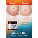 Blue Skin Care Kalça Göğüs Basen -Sıkılaştırıcı- Bölgesel İncelme-Çatlak Ve Selülit Kremi Jel 250 ML