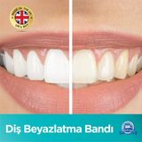 Bsolve Origin Professional Diş Beyazlatma Bantları ( 28 Paket-28 Bant) - WN105