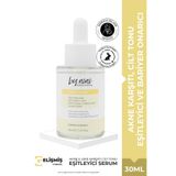By Nini Hassas Ciltler İçin Akne Karşıtı, Cilt Tonu Eşitleyici ve Bariyer Onarıcı Azelaik Asit Serum 30 ML