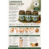 Çam Sakızı Çamsakızı Ağdası 3'lü Set 3 x 240 g | Doğal Ağda | Tüm Vücut İçin Klasik Konserve Ağda