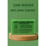Çare Burada Anti Akne Sabunu Yeşil Renkli Doğal Malzemelerle Üretilmiş Etkili Cilt Bakım Ürünü