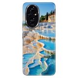 Cekuonline Honor 200 ile Uyumlu Kılıf, Pamukkale Temalı Desenli, Darbe Emici Silikon