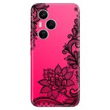 Cekuonline Honor 400 Pro ile Uyumlu Kılıf, Dantel Mandala Temalı Desenli, Darbe Emici Silikon