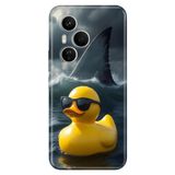 Cekuonline Honor 400 Pro ile Uyumlu Ördeğe Vız Gelmiş Temalı Desenli Darbe Emici Silikon Kılıf