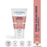 Celenes By Sweden 75 ml Cloudberry Ayak Bakım Kremi Çatlamış Topuklar İçin Yoğun Nemlendirici