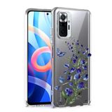 CepteCepnet Redmi Note 11S İle Uyumlu Özel Tasarım Baskılı Kamera Korumalı Şeffaf Telefon Kılıfı 4