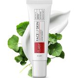 CetKing Akne Kremi Yüz Için – Sivilce ve Akne Karşıtı Leke Kremi – Salisilik Asit & Niasinamid ile Leke Giderici – Genç ve Yetişkin Cilt Bakımı, 40 ml