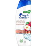 CetKing & Shoulders Arındırma ve Parlaklık Kepeğe Karşı Etkili Şampuan 330ML