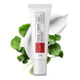 CLASYCARE Akne Kremi Yüz İçin – Sivilce ve Akne Karşıtı Leke Kremi – Salisilik Asit & Niasinamid ile Leke Giderici – Genç ve Yetişkin Cilt Bakımı, 40 ml