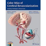 Color Atlas of Cerebral Revascularization: Anatomy, Techniques, Clinical Cases by Robert F. Spetzler (2013-02-27)