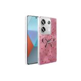 Coverzone Redmi Note 13 Pro 4G İle Uyumlu Figürlü Ponti Silikon Telefon Kılıfı Pembe Kurdele