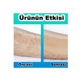 Crystal Hair Eraser Tüy Alma Cihazı