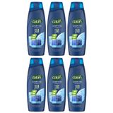 Dalan Şampuan Aloe Vera Özlü Kepeğe Karşıt Etkili 450 ml x 6 Adet