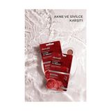Defne Store Akne ve Siyah Nokta Karşıtı Kil Maskesi 2x 7.5 ml - Option-1