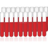Deney Tüpü Cam 16X100 Mm Test Tube X 20 Adet