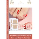 Denguva #YaraBandı Kolay Uygulanabilir Mantar Karşıtı Sararma Giderici Bakım Ayak Tırnağı Onarım Yaması