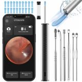 DENZI Kulak balmumu temizleme aracı kamera - ışıklı kulak balmumu temizleme aracı kamera 1080p ile 20 yedek uç kapak ve 6 kulak kiri temizleme kiti, kablosuz kulak temizleyici kamera 6 LED ışık iOS ve