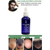 dermanew hair Dermanew Saç Losyonu Saç Bakım Yağı / 1 Adet