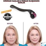 Dermaroller Köseler ve Dökülen Saçları Için Saç Sakal Çıkartıcı Gürleştirici Titanyum Iğneli 0.5 mm