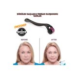 Dermaroller Köseler Ve Dökülen Saçları Için Saç Sakal Çıkartıcı Gürleştirici Titanyum Iğneli 1 Mm
