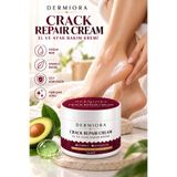 Dermiora El Ayak ve Topuk Çatlağı koku giderici beyazlatma etkili Bakım Kremi 150 ml