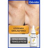 Devida Siyah Nokta Leke Karşıtı Vivo Series A210 - Siyah Nokta Akne Giderici Gözenek Sıkılaştırıcı