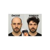 Doruk Hair Luxury Doğal Siyah Protez Gerçek Peruk