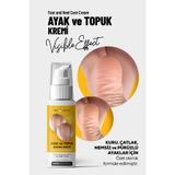 Ecc HEALTH Ayak ve Topuk Çatlak Bakım Kremi 100 ml – Kuru, Sertleşmiş ve Pürüzlü Ayaklar İçin