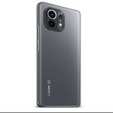 Ecr Mobile Xiaomi Mi 11 Lite Mat Arka Kaplama