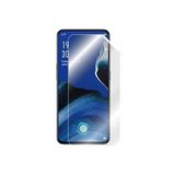 ECRMOBILE Xiaomi Mi 11 Ultra Gerçek Kırılmayan Nano Ekran Koruyucu Hd Şeffaf