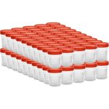 Edlab Idrar Numune Kabı 100 ml Idrar Numune Kabı 100 Adet