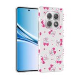 Elfia Xiaomi Redmi Note 15 5G ile Uyumlu Kılıfı Desenli Şeffaf Sert Silikon Kamera Lens Korumalı İnce Kapak Klip Kalpli Kiraz