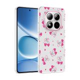 Elfia Xiaomi Redmi Note 15 Pro Plus ile Uyumlu Kılıfı Desenli Şeffaf Sert Silikon Kamera Lens Korumalı İnce Kapak Klip Kalpli Kiraz