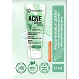 Elvons Sivilce Ve Akne Kremi- 50 Ml