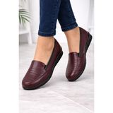 Emil Shoes Içi Hakiki Deri Kışlık Taban Tam Ortopedik Topuk Jelli Siyah Anne Ayakkabısı - Bordo