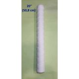 Enessu Ip Filtresi 20 Inch Su Arıtma Cihazları Sediment Filtre
