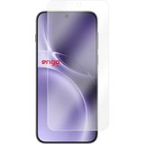 Engo Vivo X300 Pro Mat Ekran Koruyucu Parmak İzi Bırakmayan Yansıma Ve Parlama Önleyici Koruma, 9H Temperli Kırılmaz Esnek Nano Cam