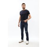 Erkek Dizi Yırtık Slim Fit Boya Detay Jean Pantolon