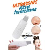 Esenliwe 4'ü 1 Arada Cilt Spatula Yüz Temizleyici Spatula, Derin Temizleyici Siyah Nokta Temizleyici Gözenek - Beyaz