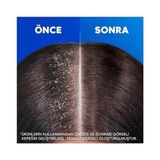 Esmo Home Head & Shoulders Nemlendirici Bakım Şampuan 330 ml - Option-1