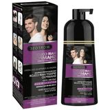 Esranın Dünyası Beyaz ve Gri Kapatıcı Şampuan - 420 ml Hızlı Etki