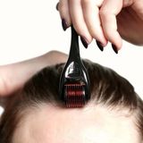 Eşya Dünyası Titanyum Uçlu 540 Needles Derma Roller Cilt Yenileme Cihazı, / Saç, Sakal, Yüz Için 1.0 mm - Kırmızı