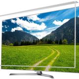 Etiasglass Lg 55UF7787 Uyumlu Tv Ekran Koruyucu