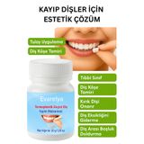 Evarelya Diş Tamiri Malzemesi – Evde Hızlı Onarım İçin Estetik Dolgu Seçeneği
