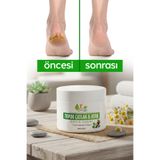 Eylife Naturel Ayak ve Topuk Çatlak Bakım Kremi 100 ml