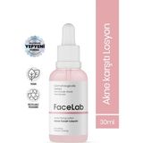 Facelab Akne ve Sivilce Kurutucu Zencefil Özlü Losyon Acne Drying Lotion 30 ml