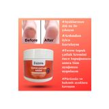 Ferew Topuk Çatlak Kremi 100 Ml
